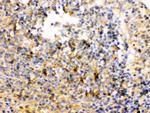 TRIB2 Antibody in Immunohistochemistry (Paraffin) (IHC (P))