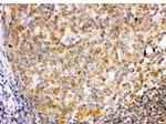 TRIB2 Antibody in Immunohistochemistry (Paraffin) (IHC (P))