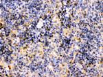 TRIB2 Antibody in Immunohistochemistry (Paraffin) (IHC (P))