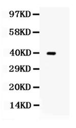 TRIB2 Antibody in Western Blot (WB)