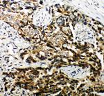 TSC1 Antibody in Immunohistochemistry (Paraffin) (IHC (P))