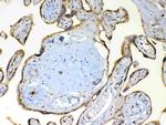 TSPAN12 Antibody in Immunohistochemistry (Paraffin) (IHC (P))