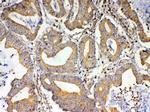 TSPAN12 Antibody in Immunohistochemistry (Paraffin) (IHC (P))