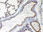 TSPAN12 Antibody in Immunohistochemistry (Paraffin) (IHC (P))