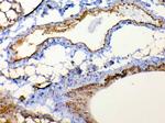 TSPAN12 Antibody in Immunohistochemistry (Paraffin) (IHC (P))