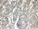 TSPAN12 Antibody in Immunohistochemistry (Paraffin) (IHC (P))