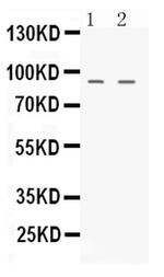 UHRF2 Antibody in Western Blot (WB)