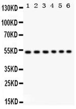 ULK3 Antibody in Western Blot (WB)