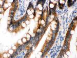 UPF1 Antibody in Immunohistochemistry (Paraffin) (IHC (P))