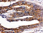 UPF1 Antibody in Immunohistochemistry (Paraffin) (IHC (P))