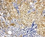 Vinculin Antibody in Immunohistochemistry (Paraffin) (IHC (P))