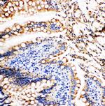 Vinculin Antibody in Immunohistochemistry (Paraffin) (IHC (P))