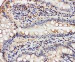 VCP Antibody in Immunohistochemistry (Paraffin) (IHC (P))