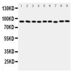 VCP Antibody in Western Blot (WB)