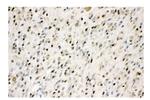 VCP Antibody in Immunohistochemistry (Paraffin) (IHC (P))