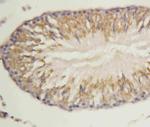 MORG1 Antibody in Immunohistochemistry (Paraffin) (IHC (P))