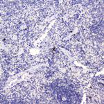 WFDC2 Antibody in Immunohistochemistry (Paraffin) (IHC (P))