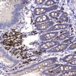 WFDC2 Antibody in Immunohistochemistry (Paraffin) (IHC (P))