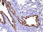 WFDC2 Antibody in Immunohistochemistry (Paraffin) (IHC (P))