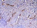 WFDC2 Antibody in Immunohistochemistry (Paraffin) (IHC (P))