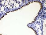 WFDC2 Antibody in Immunohistochemistry (Paraffin) (IHC (P))