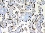 XRCC1 Antibody in Immunohistochemistry (Paraffin) (IHC (P))