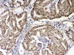 XRCC1 Antibody in Immunohistochemistry (Paraffin) (IHC (P))