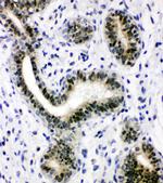 XRCC1 Antibody in Immunohistochemistry (Paraffin) (IHC (P))