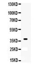 XRCC3 Antibody in Western Blot (WB)