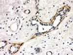 YES1 Antibody in Immunohistochemistry (Paraffin) (IHC (P))