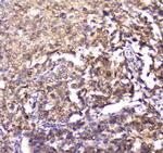 14-3-3 zeta Antibody in Immunohistochemistry (Paraffin) (IHC (P))