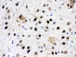 ZWINT Antibody in Immunohistochemistry (Paraffin) (IHC (P))