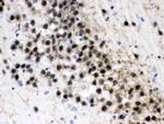 ZWINT Antibody in Immunohistochemistry (Paraffin) (IHC (P))