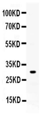 ZWINT Antibody in Western Blot (WB)