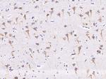 ENPP2 Antibody in Immunohistochemistry (Paraffin) (IHC (P))