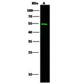 LOX-1 Antibody in Western Blot (WB)