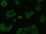 ABCD1 Antibody in Immunocytochemistry (ICC/IF)