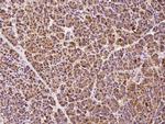 ABCD1 Antibody in Immunohistochemistry (Paraffin) (IHC (P))