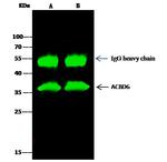 ACBD6 Antibody in Immunoprecipitation (IP)