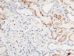 ACOX1 Antibody in Immunohistochemistry (Paraffin) (IHC (P))