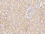 Acid Phosphatase 1 Antibody in Immunohistochemistry (Paraffin) (IHC (P))