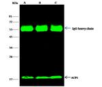 Acid Phosphatase 1 Antibody in Immunoprecipitation (IP)