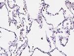 Tartrate Resistant Acid Phosphatase Antibody in Immunohistochemistry (Paraffin) (IHC (P))