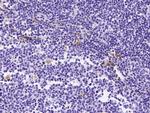 Tartrate Resistant Acid Phosphatase Antibody in Immunohistochemistry (Paraffin) (IHC (P))