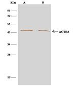 Arp3 Antibody in Immunoprecipitation (IP)