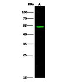 ACVRL1 Antibody in Western Blot (WB)