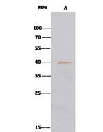 Aminoacylase Antibody in Immunoprecipitation (IP)