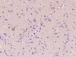 Adenosine Deaminase Antibody in Immunohistochemistry (Paraffin) (IHC (P))