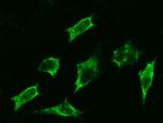 beta-2 Adrenergic Receptor Antibody in Immunocytochemistry (ICC/IF)