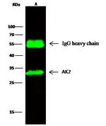 Adenylate Kinase 2 Antibody in Immunoprecipitation (IP)